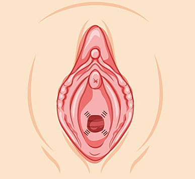 Hymenorrhaphy