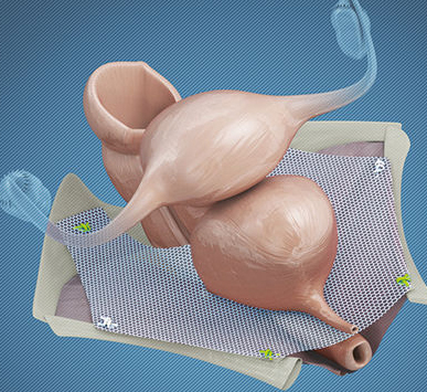 Serivce Image