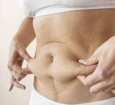 Vulvoplasty